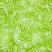 Feuille d'Hibiscus observée au microscope. Stomates visibles.